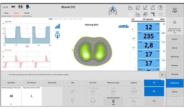 Elisa Ventilator l The imaging navigation system for intensive care ventilation. การวัดปริมาตรปอดด้วยความต่างศักย์ของไฟฟ้า