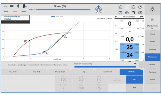 Elisa Ventilator l เครื่องมือวิเคราะห์หาค่า PEEP ที่เหมาะสม